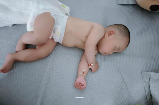 赤壁六个月宝宝眼睛散光